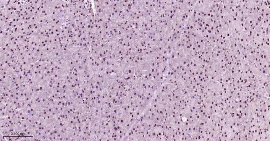 异染色质蛋白1-α重组兔单抗-bsm-61202R