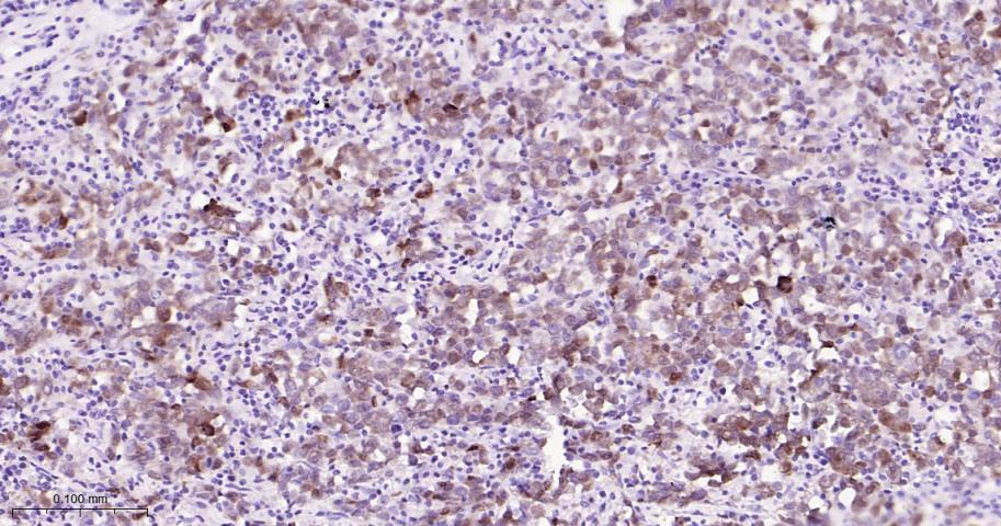 泛素结合蛋白P62重组兔单抗