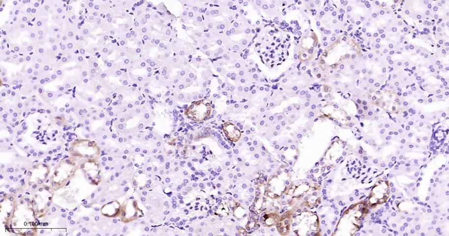 磷酸化丝裂原活化蛋白激酶激酶1重组兔单抗