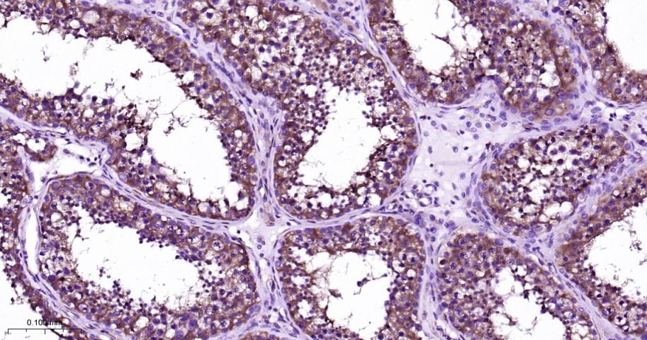 微管结合蛋白CYLD单克隆抗体-bsm-51375M
