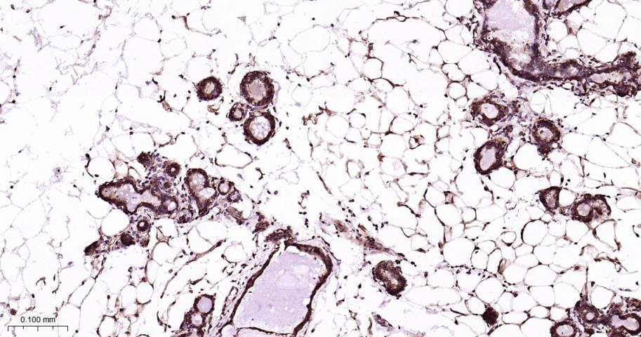 蛋白酶体PSMα1重组兔单抗-bsm-60572R
