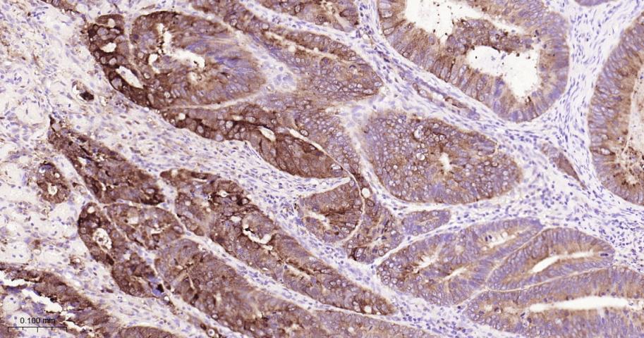 泛素结合蛋白P62重组兔单抗