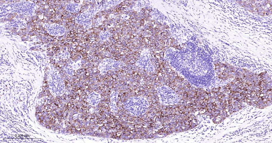 细胞角蛋白7重组兔单抗