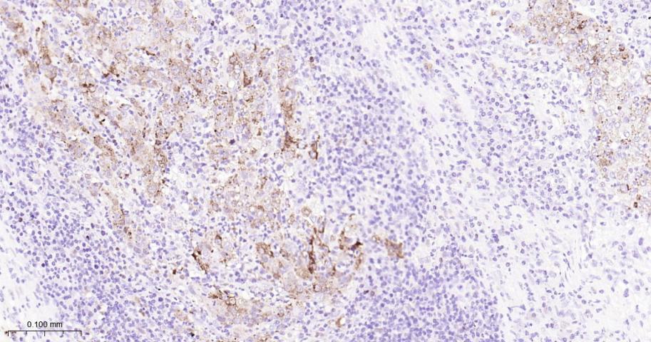 泛素结合蛋白P62重组兔单抗