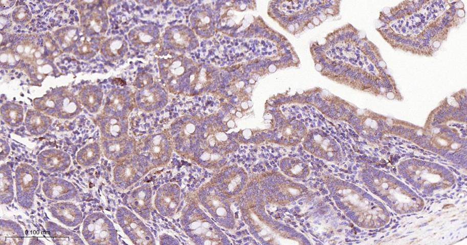 泛素结合蛋白P62重组兔单抗