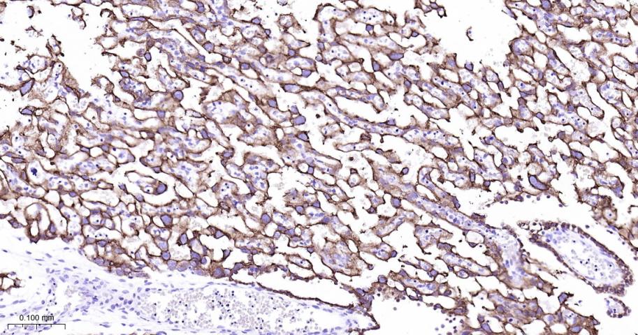 细胞角蛋白7重组兔单抗