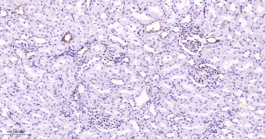 磷酸化丝裂原活化蛋白激酶激酶1重组兔单抗