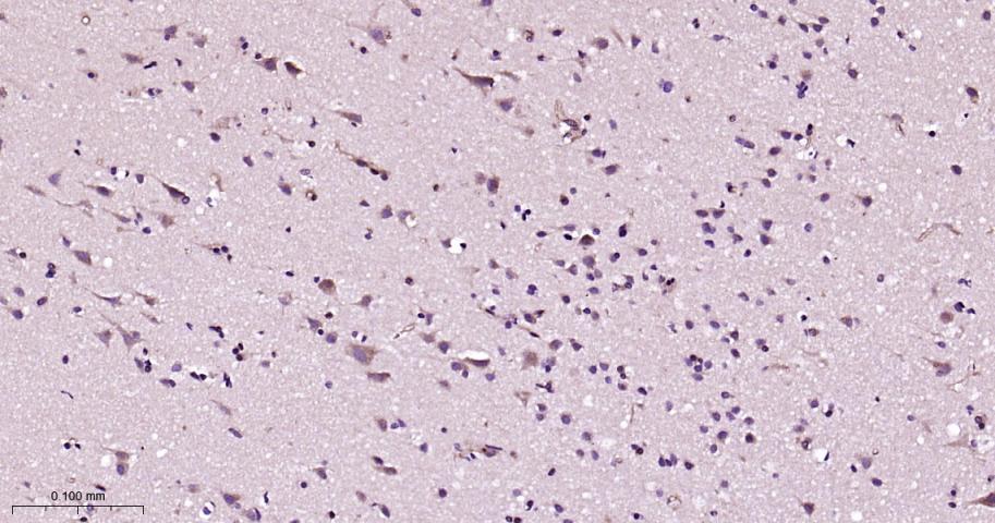 微管结合蛋白CYLD单克隆抗体-bsm-51375M