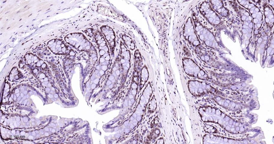 异染色质蛋白1-α重组兔单抗-bsm-61202R