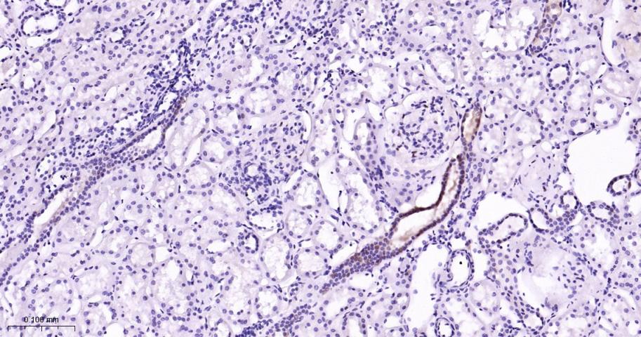 磷酸化丝裂原活化蛋白激酶激酶1重组兔单抗