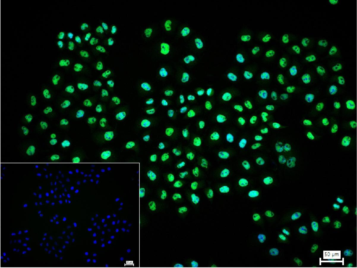 环指蛋白75重组兔单抗