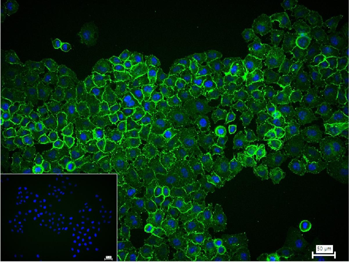小鼠抗人CD44单克隆抗体-bsm-30038M