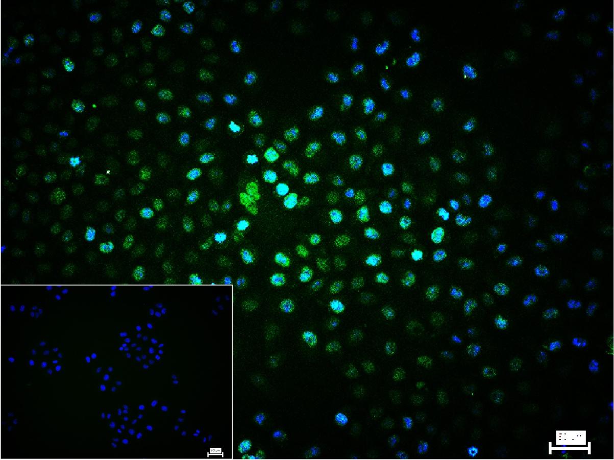 组蛋白H3(核内参)重组兔单抗