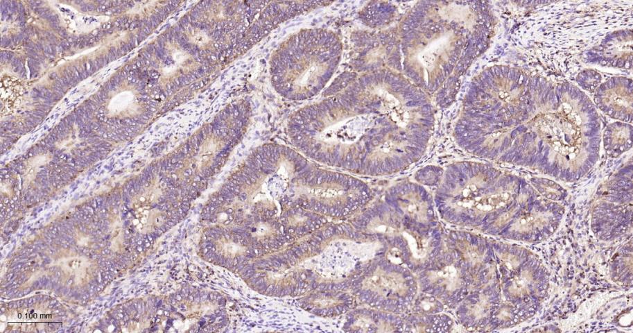 磷酸变位酶1重组兔单抗