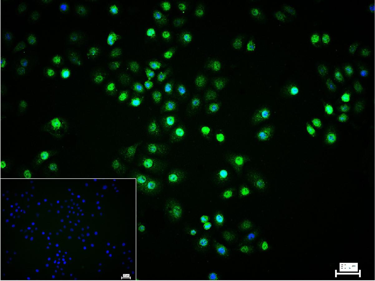 缺氧诱导因子1α 单克隆抗体-bsm-33428M