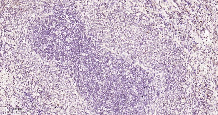 磷酸化细胞肿瘤抗原P53抗体-bs-3705R