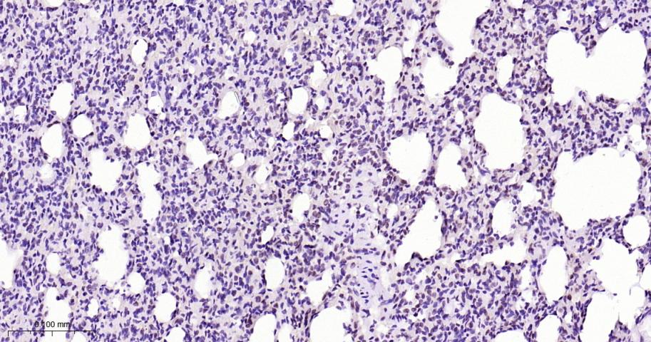 磷酸化信号转导和转录激活因子3抗体-bs-22386R