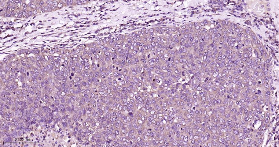 蛋白激酶C α重组兔单抗