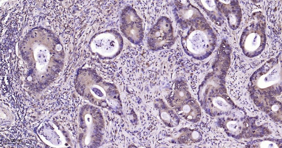 丝裂原活化蛋白激酶1/ERK 1/2重组兔单抗