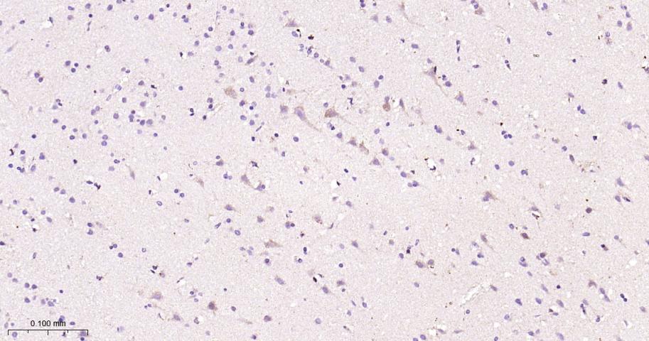 信号转导和转录激活因子3单克隆抗体-bsm-33223M