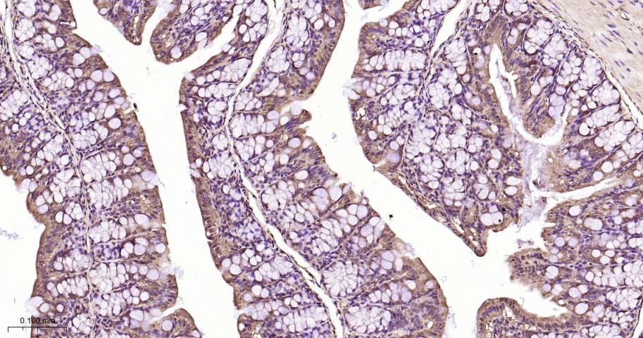 丝裂原活化蛋白激酶1/ERK 1/2重组兔单抗