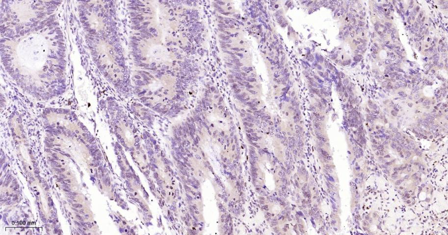 磷酸化细胞肿瘤抗原P53抗体-bs-3705R