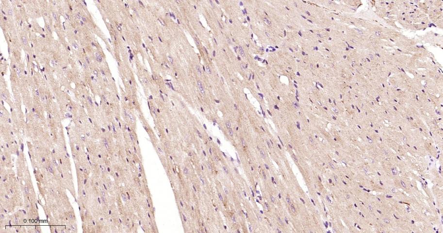 信号转导和转录激活因子3抗体-bs-20382R