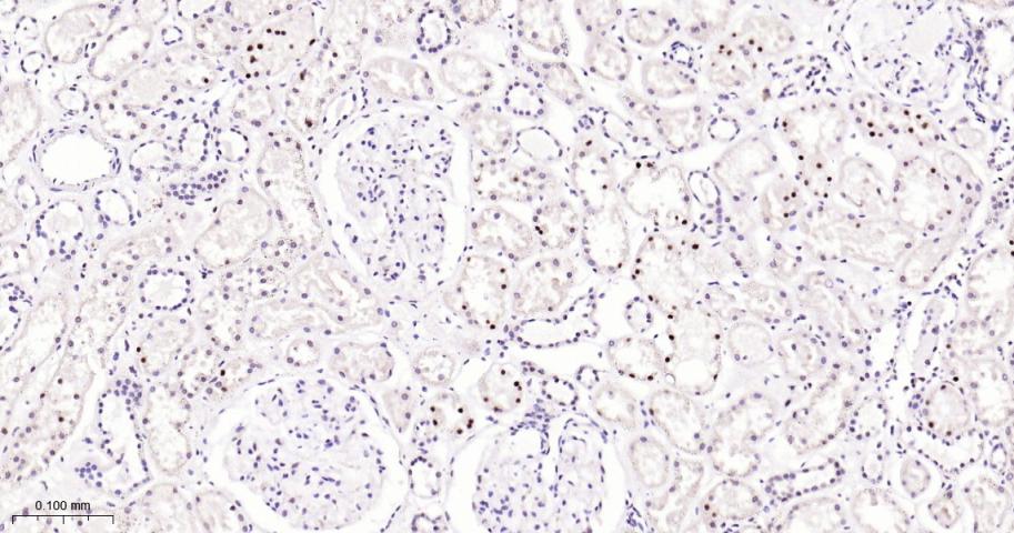 磷酸化信号转导和转录激活因子3抗体-bs-22386R