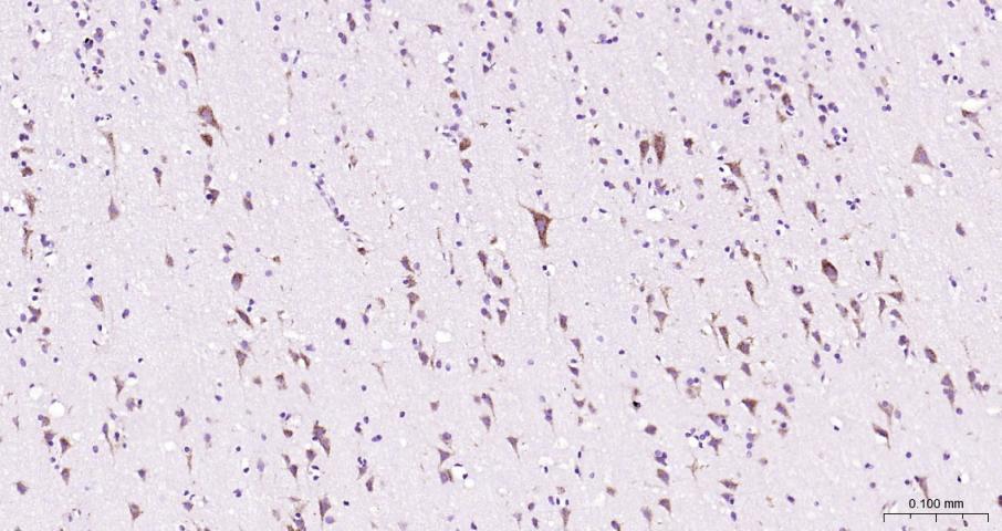 组织蛋白酶B重组兔单抗
