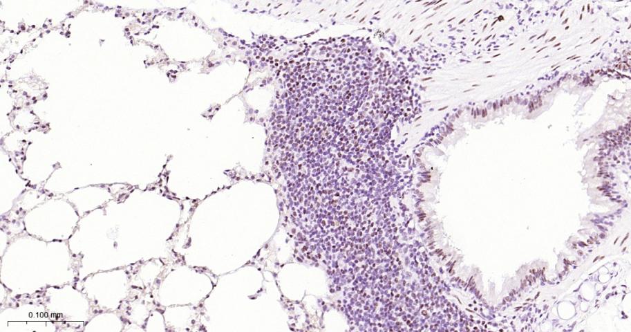叉头蛋白P1重组兔单抗