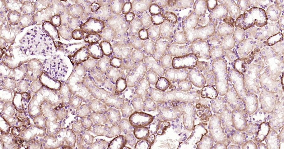 信号转导和转录激活因子3抗体-bs-20382R