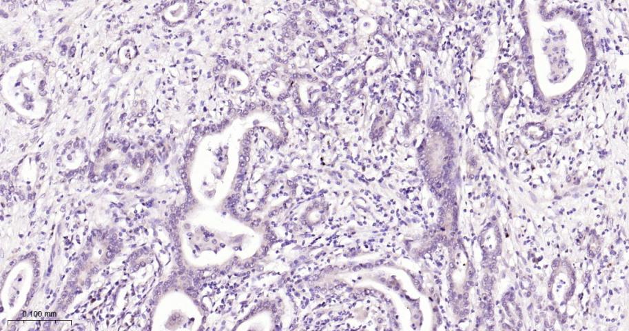 NADPH氧化酶4抗体