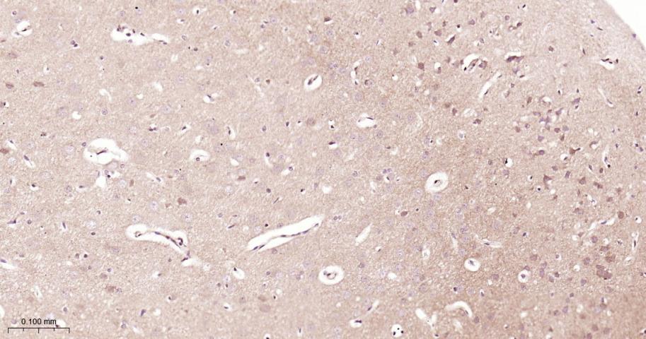 信号转导和转录激活因子3抗体-bs-20382R