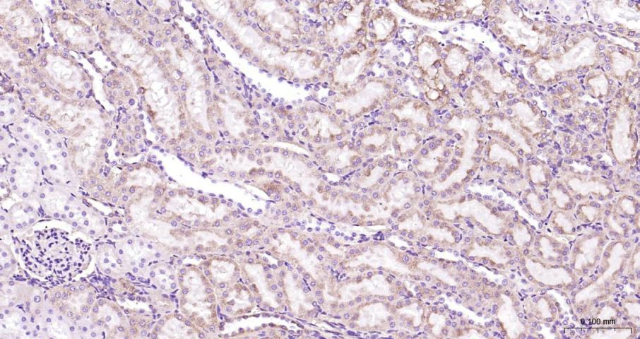 蛋白酶激活受体-2重组兔单抗