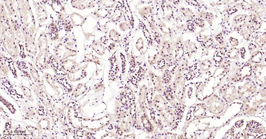 丝裂原活化蛋白激酶1/ERK 1/2重组兔单抗