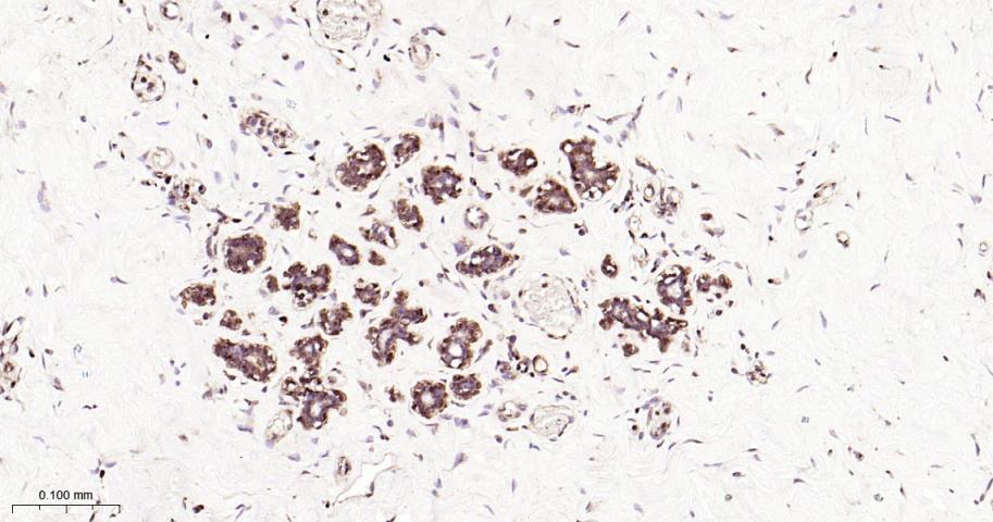 丝裂原活化蛋白激酶1/ERK 1/2重组兔单抗