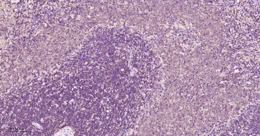 蛋白激酶C α重组兔单抗