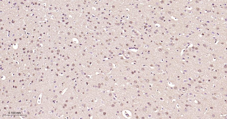 丝裂原活化蛋白激酶1/ERK 1/2重组兔单抗