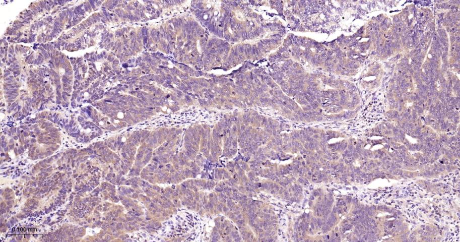 信号转导和转录激活因子3抗体-bs-20382R