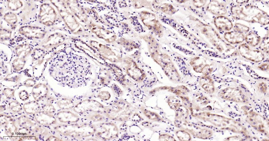 信号转导和转录激活因子3单克隆抗体-bsm-33218M