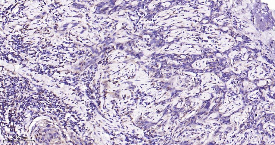 丝裂原活化蛋白激酶1/ERK 1/2重组兔单抗