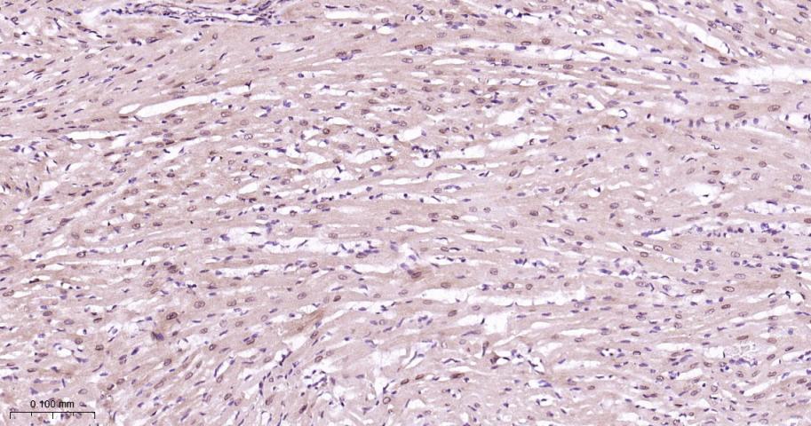蛋白酶调解因子14重组兔单抗
