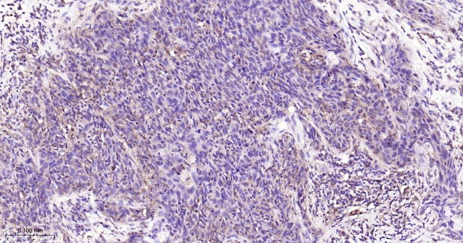 信号转导和转录激活因子3单克隆抗体-bsm-33223M
