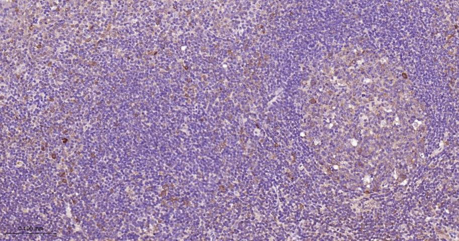 信号转导和转录激活因子3单克隆抗体-bsm-33223M