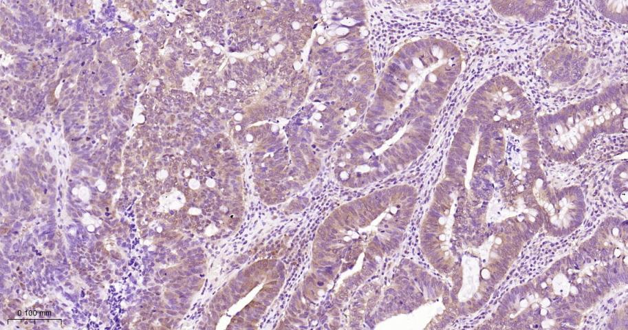 信号转导和转录激活因子3单克隆抗体-bsm-33218M