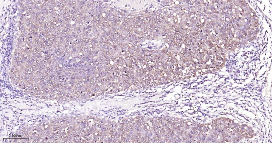 信号转导和转录激活因子3单克隆抗体-bsm-33218M