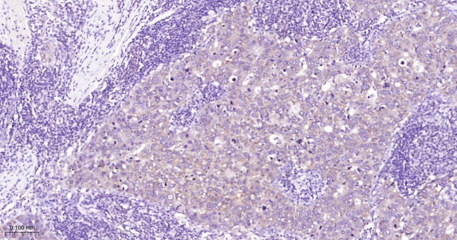 信号转导和转录激活因子3单克隆抗体-bsm-33223M