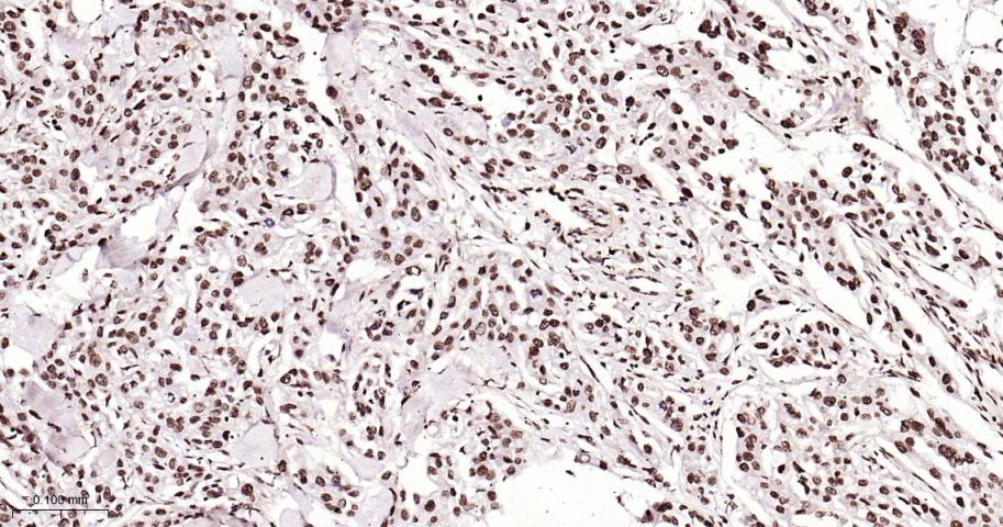 磷酸化细胞肿瘤抗原P53抗体-bs-3705R