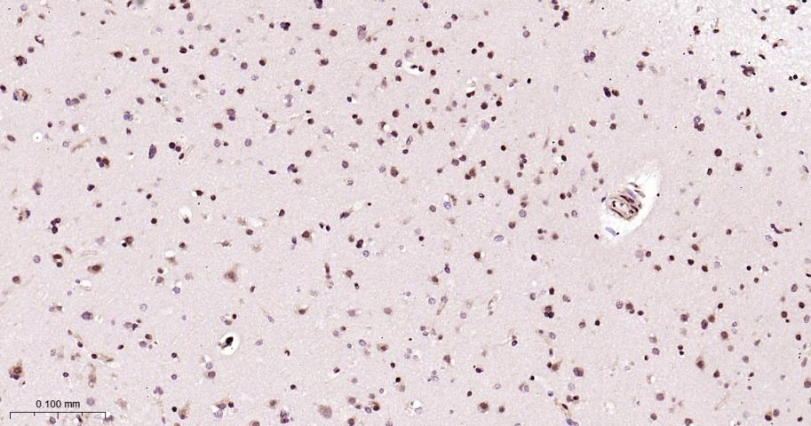 磷酸化细胞肿瘤抗原P53抗体-bs-3705R