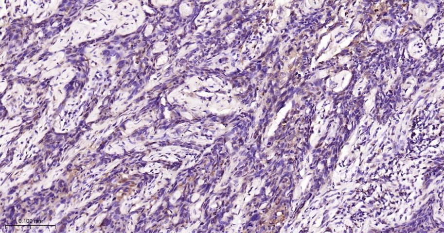 信号转导和转录激活因子3抗体-bs-20382R